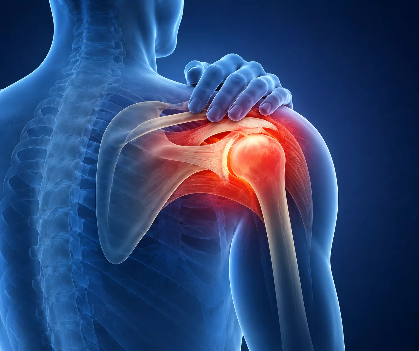 Frozen shoulder treatment service