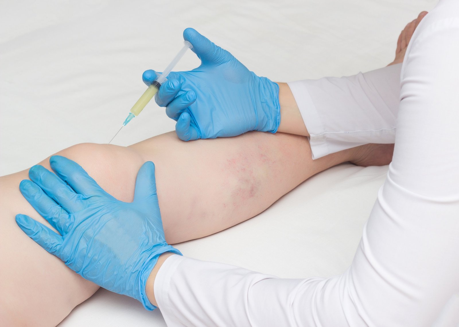 Ozone therapy treatment support